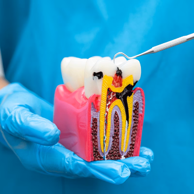 root canal near me massillon dentist boss family dentistry (1)-min root canal near me massillon dentist boss family dentistry